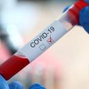 + de 400 nouveaux cas de coronavirus recensés en 24h, dans les Hauts de France