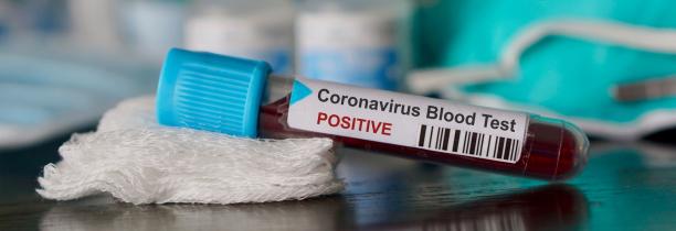 Coronavirus : 577 cas en France, dont 9 morts