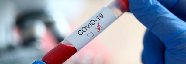 Covid-19 : Bilan, dans les Hauts de France, 3900 cas confirmés