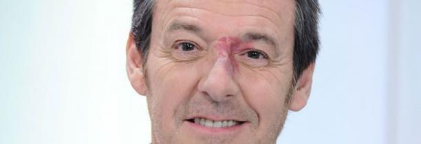 Jean-Luc Reichmann est positif au Covid